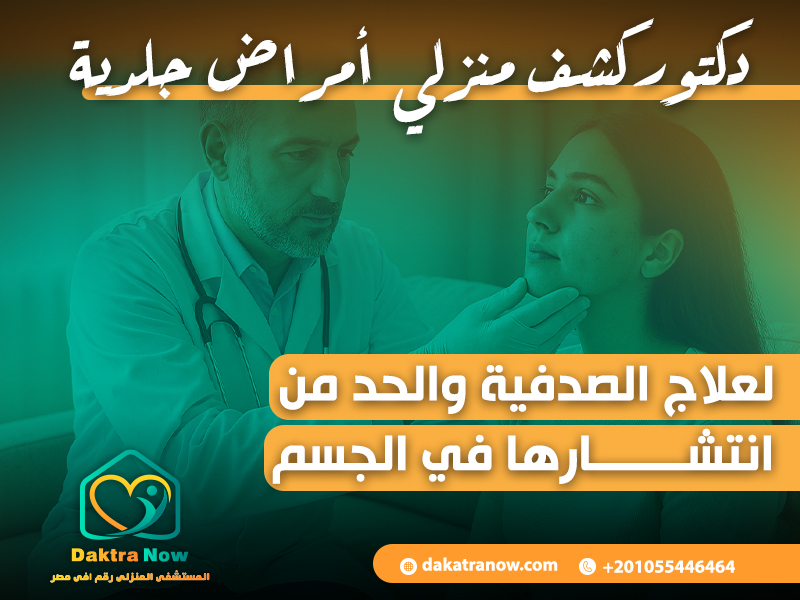 دكتور كشف منزلي أمراض جلدية لعلاج الصدفية والحد من انتشارها في الجسم